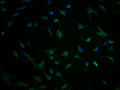 Immunofluorescence staining of U251 cells with CSB-PA732237LA11HU at 1:100, counter-stained with DAPI. The cells were fixed in 4% formaldehyde and blocked in 10% normal Goat Serum. The cells were then incubated with the antibody overnight at 4°C. The secondary antibody was Alexa Fluor 488-congugated AffiniPure Goat Anti-Rabbit IgG(H+L).