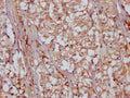 IHC image of CSB-PA732918LA01HU diluted at 1:200 and staining in paraffin-embedded human adrenal gland tissue performed on a Leica BondTM system. After dewaxing and hydration, antigen retrieval was mediated by high pressure in a citrate buffer (pH 6.0). Section was blocked with 10% normal goat serum 30min at RT. Then primary antibody (1% BSA) was incubated at 4°C overnight. The primary is detected by a Goat anti-rabbit IgG labeled by HRP and visualized using 0.05% DAB.