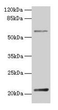 DUSP13 Antibody – Figure 1 of 4