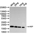 Western Blot
Positive WB detected in: recombinant protein
All lanes:MUS81 Antibody at 1:1000
Secondary
Goat polyclonal to rabbit IgG at 1/20000 dilution
Predicted band size: 36.5 kDa
Observed band size: 36.5 kDa