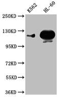 Western Blot
Positive WB detected in: K562 whole cell lysate,HL-60 whole cell lysate
All lanes: POTEE antibody at 1:1000
Secondary
Goat polyclonal to rabbit IgG at 1/50000 dilution
Predicted band size: 122 kDa
Observed band size: 122 kDa