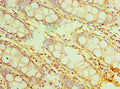 Immunohistochemistry of paraffin-embedded human colon tissue using CSB-PA740921ESR2HU at dilution of 1:100