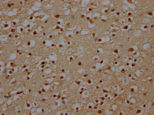 IHC image of CSB-PA740936LA01HU diluted at 1:140 and staining in paraffin-embedded human brain tissue performed on a Leica BondTM system. After dewaxing and hydration, antigen retrieval was mediated by high pressure in a citrate buffer (pH 6.0). Section was blocked with 10% normal goat serum 30min at RT. Then primary antibody (1% BSA) was incubated at 4°C overnight. The primary is detected by a Goat anti-rabbit IgG labeled by HRP and visualized using 0.05% DAB.