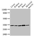 Western Blot
Positive WB detected in: Rat liver tissue, Rat kidney tissue, Mouse brain tissue, Mouse heart tissue, Mouse skeletal muscle tissue
All lanes: AHSA2P antibody at 3µg/ml
Secondary
Goat polyclonal to rabbit IgG at 1/50000 dilution
Predicted band size: 34, 17, 16 kDa
Observed band size: 34 kDa