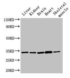 Western Blot
Positive WB detected in: Rat liver tissue, Rat kidney tissue, Mouse brain tissue, Mouse heart tissue, Mouse skeletal muscle tissue
All lanes: AHSA2P antibody at 3µg/ml
Secondary
Goat polyclonal to rabbit IgG at 1/50000 dilution
Predicted band size: 34, 17, 16 kDa
Observed band size: 34 kDa