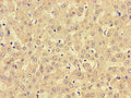 Immunohistochemistry of paraffin-embedded human liver tissue using CSB-PA744028LA01HU at dilution of 1:100