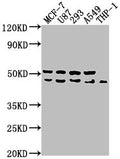 Western Blot
Positive WB detected in: MCF-7 whole cell lysate, U87 whole cell lysate, 293 whole cell lysate, A549 whole cell lysate, THP-1 whole cell lysate
All lanes: WDR73 antibody at 1:1000
Secondary
Goat polyclonal to rabbit IgG at 1/50000 dilution
Predicted band size: 42 kDa
Observed band size: 42 kDa