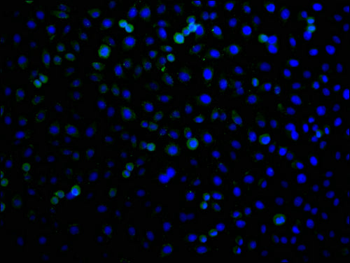 Immunofluorescence staining of A549 cells with CSB-PA744137LA21HU at 1:100, counter-stained with DAPI. The cells were fixed in 4% formaldehyde and blocked in 10% normal Goat Serum. The cells were then incubated with the antibody overnight at 4°C. The secondary antibody was Alexa Fluor 488-congugated AffiniPure Goat Anti-Rabbit IgG(H+L).