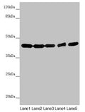 Western blot All lanes: EIF3M antibody at 2.02µg/ml Lane 1: Hela whole cell lysate Lane 2: A549 whole cell lysate Lane 3: Mouse gonadal tissue Lane 4: Human placenta tissue Lane 5: Mouse brain tissue Secondary Goat polyclonal to rabbit IgG at 1/10000 dilution Predicted band size: 43, 28 kDa Observed band size: 43 kDa