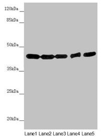 Western blot All lanes: EIF3M antibody at 2.02µg/ml Lane 1: Hela whole cell lysate Lane 2: A549 whole cell lysate Lane 3: Mouse gonadal tissue Lane 4: Human placenta tissue Lane 5: Mouse brain tissue Secondary Goat polyclonal to rabbit IgG at 1/10000 dilution Predicted band size: 43, 28 kDa Observed band size: 43 kDa