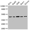 Western Blot
Positive WB detected in: Hela whole cell lysate, HepG2 whole cell lysate, A549 whole cell lysate, Rat heart tissue, Rat spleen tissue
All lanes: EIF3M antibody at 2.7µg/ml
Secondary
Goat polyclonal to rabbit IgG at 1/50000 dilution
Predicted band size: 43, 28 kDa
Observed band size: 43 kDa