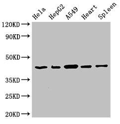Western Blot
Positive WB detected in: Hela whole cell lysate, HepG2 whole cell lysate, A549 whole cell lysate, Rat heart tissue, Rat spleen tissue
All lanes: EIF3M antibody at 2.7µg/ml
Secondary
Goat polyclonal to rabbit IgG at 1/50000 dilution
Predicted band size: 43, 28 kDa
Observed band size: 43 kDa