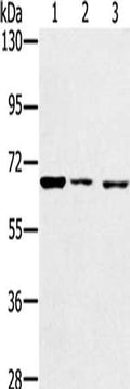 Gel: 6%SDS-PAGE, Lysate: 40 ug, Lane 1-3: A172 cells, hela cells, hepg2 cells, Primary antibody: CSB-PA745585(IGF2BP3 Antibody) at dilution 1/200, Secondary antibody: Goat anti rabbit IgG at 1/8000 dilution, Exposure time: 20 seconds