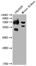 Western Blot
Positive WB detected in: COLO320 whole cell lysate, Mouse Kidney tissue
All lanes: SLC39A4 antibody at 1:2000
Secondary
Goat polyclonal to rabbit IgG at 1/50000 dilution
Predicted band size: 69, 67 kDa
Observed band size: 69 kDa