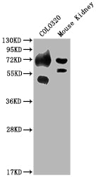 Western Blot
Positive WB detected in: COLO320 whole cell lysate, Mouse Kidney tissue
All lanes: SLC39A4 antibody at 1:2000
Secondary
Goat polyclonal to rabbit IgG at 1/50000 dilution
Predicted band size: 69, 67 kDa
Observed band size: 69 kDa