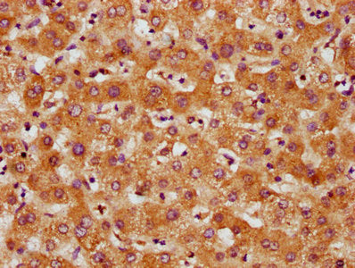 IHC image of CSB-PA747623LA01HU diluted at 1:500 and staining in paraffin-embedded human liver tissue performed on a Leica BondTM system. After dewaxing and hydration, antigen retrieval was mediated by high pressure in a citrate buffer (pH 6.0). Section was blocked with 10% normal goat serum 30min at RT. Then primary antibody (1% BSA) was incubated at 4°C overnight. The primary is detected by a biotinylated secondary antibody and visualized using an HRP conjugated SP system.