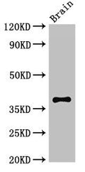 Western Blot
Positive WB detected in: Mouse brain tissue
All lanes: CASP12 antibody at 2.7ug/ml
Secondary
Goat polyclonal to rabbit IgG at 1/50000 dilution
Predicted band size: 39, 20, 30 kDa
Observed band size: 39 kDa