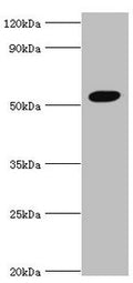 Western blot
All lanes: Zinc finger protein AEBP2 antibody at 4ug/ml + Hela whole cell lysate
Secondary
Goat polyclonal to rabbit IgG at 1/10000 dilution
Predicted band size: 55, 53, 34 kDa
Observed band size: 55 kDa