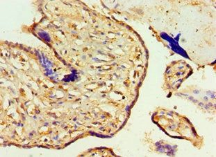 Immunohistochemistry of paraffin-embedded human placenta tissue using CSB-PA747778ESR2HU at dilution of 1:100