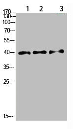 Western Blot analysis of 1,mouse-lung 2,mouse-brain 3,mouse-spleen cells using primary antibody diluted at 1:500(4°C overnight). Secondary antibody:Goat Anti-rabbit IgG IRDye 800( diluted at 1:5000, 25°C, 1 hour)