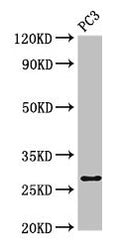 Western Blot
Positive WB detected in: PC-3 whole cell lysate
All lanes: IL34 antibody at 4µg/ml
Secondary
Goat polyclonal to rabbit IgG at 1/50000 dilution
Predicted band size: 28 kDa
Observed band size: 28 kDa