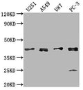 Western Blot
Positive WB detected in: U251 whole cell lysate, A549 whole cell lysate, U87 whole cell lysate, PC-3 whole cell lysate
All lanes: IKBIP antibody at 1:1000
Secondary
Goat polyclonal to rabbit IgG at 1/50000 dilution
Predicted band size: 40 kDa
Observed band size: 40 kDa
