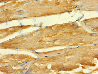 Immunohistochemistry of paraffin-embedded human skeletal muscle tissue using CSB-PA753612LA01HU at dilution of 1:100