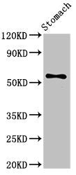 Western Blot
Positive WB detected in: Mouse stomach tissue
All lanes: SMARCD3 antibody at 3.4ug/ml
Secondary
Goat polyclonal to rabbit IgG at 1/50000 dilution
Predicted band size: 56, 54 kDa
Observed band size: 56 kDa