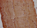 IHC image of CSB-PA754631LA01HU diluted at 1:200 and staining in paraffin-embedded human skeletal muscle tissue performed on a Leica BondTM system. After dewaxing and hydration, antigen retrieval was mediated by high pressure in a citrate buffer (pH 6.0). Section was blocked with 10% normal goat serum 30min at RT. Then primary antibody (1% BSA) was incubated at 4°C overnight. The primary is detected by a Goat anti-rabbit polymer IgG labeled by HRP and visualized using 0.05% DAB.