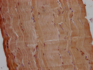 IHC image of CSB-PA754631LA01HU diluted at 1:200 and staining in paraffin-embedded human skeletal muscle tissue performed on a Leica BondTM system. After dewaxing and hydration, antigen retrieval was mediated by high pressure in a citrate buffer (pH 6.0). Section was blocked with 10% normal goat serum 30min at RT. Then primary antibody (1% BSA) was incubated at 4°C overnight. The primary is detected by a Goat anti-rabbit polymer IgG labeled by HRP and visualized using 0.05% DAB.