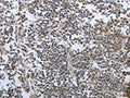 The image on the left is immunohistochemistry of paraffin-embedded Human tonsil tissue using CSB-PA755885(PRL Antibody) at dilution 1/30, on the right is treated with fusion protein. (Original magnification: ×200)