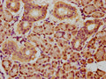 IHC image of CSB-PA755911LA01HU diluted at 1:150 and staining in paraffin-embedded human pancreatic tissue performed on a Leica BondTM system. After dewaxing and hydration, antigen retrieval was mediated by high pressure in a citrate buffer (pH 6.0). Section was blocked with 10% normal goat serum 30min at RT. Then primary antibody (1% BSA) was incubated at 4°C overnight. The primary is detected by a biotinylated secondary antibody and visualized using an HRP conjugated SP system.