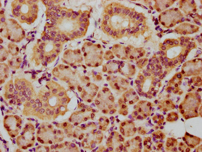 IHC image of CSB-PA755911LA01HU diluted at 1:150 and staining in paraffin-embedded human pancreatic tissue performed on a Leica BondTM system. After dewaxing and hydration, antigen retrieval was mediated by high pressure in a citrate buffer (pH 6.0). Section was blocked with 10% normal goat serum 30min at RT. Then primary antibody (1% BSA) was incubated at 4°C overnight. The primary is detected by a biotinylated secondary antibody and visualized using an HRP conjugated SP system.