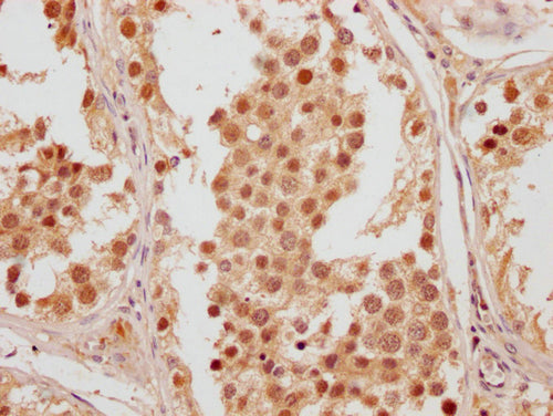 IHC image of CSB-PA757499LA01HU diluted at 1:200 and staining in paraffin-embedded human testis tissue performed on a Leica BondTM system. After dewaxing and hydration, antigen retrieval was mediated by high pressure in a citrate buffer (pH 6.0). Section was blocked with 10% normal goat serum 30min at RT. Then primary antibody (1% BSA) was incubated at 4°C overnight. The primary is detected by a Goat anti-rabbit polymer IgG labeled by HRP and visualized using 0.05% DAB.
