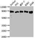 Western Blot
Positive WB detected in: Jurkat whole cell lysate, PC3 whole cell lysate, MCF-7 whole cell lysate, K562 whole cell lysate, A549 whole cell lysate
All lanes: BRAT1 antibody at 1:2000
Secondary
Goat polyclonal to rabbit IgG at 1/50000 dilution
Predicted band size: 89, 31, 32 kDa
Observed band size: 89 kDa