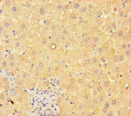 Immunohistochemistry of paraffin-embedded human liver tissue using CSB-PA757793LA01HU at dilution of 1:100