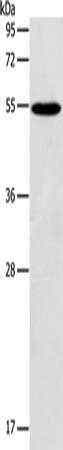 Gel: 10%SDS-PAGE, Lysate: 40 ug, Lane: Mouse testis tissue, Primary antibody: CSB-PA758696(AGPAT6 Antibody) at dilution 1/117, Secondary antibody: Goat anti rabbit IgG at 1/8000 dilution, Exposure time: 5 seconds