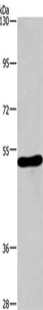 Gel: 10%SDS-PAGE, Lysate: 40 ug, Lane: Mouse brain tissue, Primary antibody: CSB-PA759611(CHRM1 Antibody) at dilution 1/375, Secondary antibody: Goat anti rabbit IgG at 1/8000 dilution, Exposure time: 5 minutes