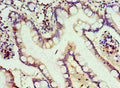 Immunohistochemistry of paraffin-embedded human small intestine tissue using CSB-PA761219ESR1HU at dilution of 1:100