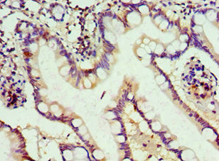 Immunohistochemistry of paraffin-embedded human small intestine tissue using CSB-PA761219ESR1HU at dilution of 1:100