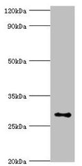 Western blot
All lanes: Alpha-ketoglutarate-dependent dioxygenase alkB homolog 2 antibody at 2ug/ml + Hela whole cell lysate
Secondary
Goat polyclonal to rabbit IgG at 1/10000 dilution
Predicted band size: 30, 18 kDa
Observed band size: 30 kDa