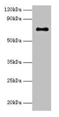 Western blot
All lanes: Adck2 antibody at 2µg/ml + K562 whole cell lysate
Secondary
Goat polyclonal to rabbit IgG at 1/15000 dilution
Predicted band size: 69 kDa
Observed band size: 69 kDa