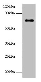 Western blot
All lanes: Adck2 antibody at 2µg/ml + K562 whole cell lysate
Secondary
Goat polyclonal to rabbit IgG at 1/15000 dilution
Predicted band size: 69 kDa
Observed band size: 69 kDa