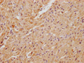 IHC image of CSB-PA761294LA01HU diluted at 1:100 and staining in paraffin-embedded human heart tissue performed on a Leica BondTM system. After dewaxing and hydration, antigen retrieval was mediated by high pressure in a citrate buffer (pH 6.0). Section was blocked with 10% normal goat serum 30min at RT. Then primary antibody (1% BSA) was incubated at 4°C overnight. The primary is detected by a Goat anti-rabbit polymer IgG labeled by HRP and visualized using 0.05% DAB.