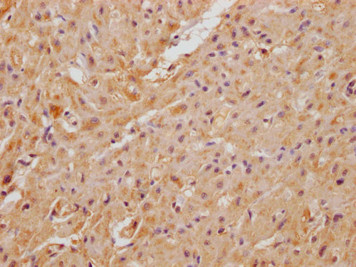 IHC image of CSB-PA761294LA01HU diluted at 1:100 and staining in paraffin-embedded human heart tissue performed on a Leica BondTM system. After dewaxing and hydration, antigen retrieval was mediated by high pressure in a citrate buffer (pH 6.0). Section was blocked with 10% normal goat serum 30min at RT. Then primary antibody (1% BSA) was incubated at 4°C overnight. The primary is detected by a Goat anti-rabbit polymer IgG labeled by HRP and visualized using 0.05% DAB.