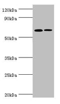 Western blot All lanes: IL27RA antibody at 9ug/ml Lane 1: Rat heart tissue Lane 2: Rat brain tissue Secondary Goat polyclonal to rabbit IgG at 1/10000 dilution Predicted band size: 69 kDa Observed band size: 69 kDa