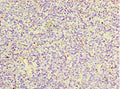 Immunohistochemistry of paraffin-embedded human tonsil tissue using CSB-PA761488ESR2HU at dilution of 1:100