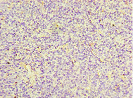 Immunohistochemistry of paraffin-embedded human tonsil tissue using CSB-PA761488ESR2HU at dilution of 1:100