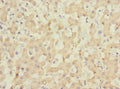 Immunohistochemistry of paraffin-embedded human liver tissue using CSB-PA761506ESR1HU at dilution of 1:100