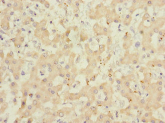 Immunohistochemistry of paraffin-embedded human liver tissue using CSB-PA761506ESR1HU at dilution of 1:100
